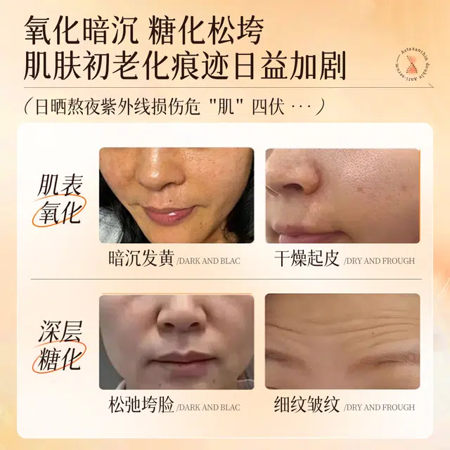 30ml