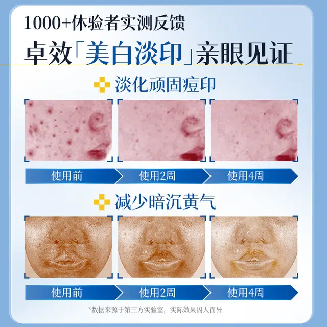 B5 120ml+100ml
