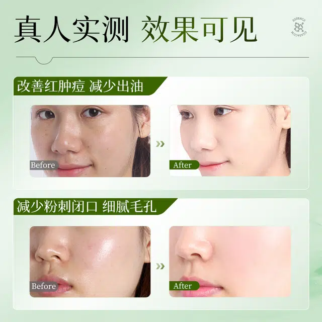 30ml