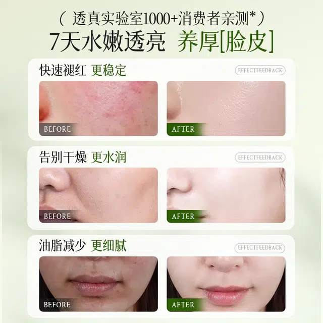 透真 灵芝菌菇精华爽肤水 保湿修护控油提亮收缩毛孔滋润祛粉刺维稳舒缓补水 去黄去闭口油皮干皮清爽型敏感肌减退泛红精粹水