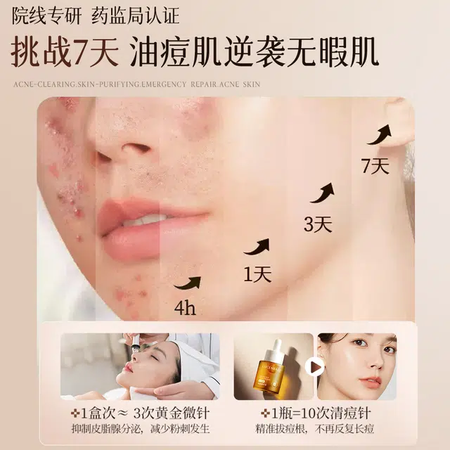 35ml