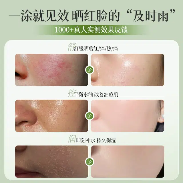 透真  修护晒后清爽补水芦荟胶面霜 舒缓保湿