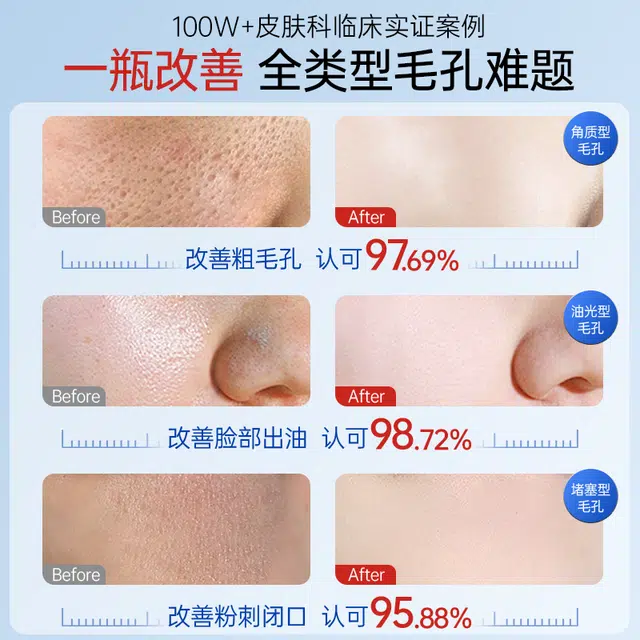 30ml