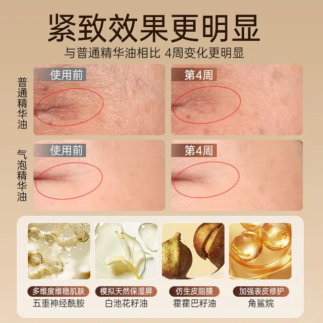 A 30ml