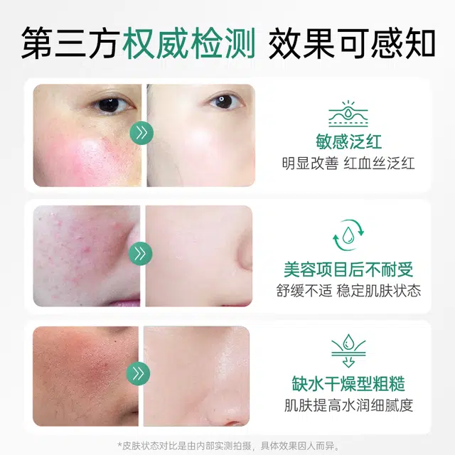 25ml*10