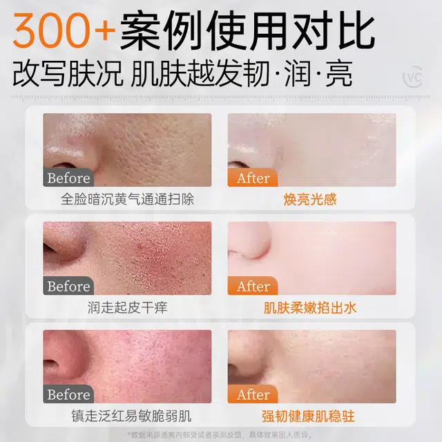 C 300ml