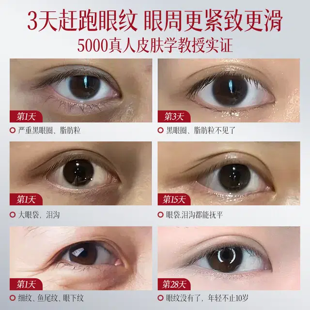 透真 润白电动按摩眼霜 提亮美白淡化眼袋提拉紧致改善眼部暗沉 去黑眼圈保湿滋润