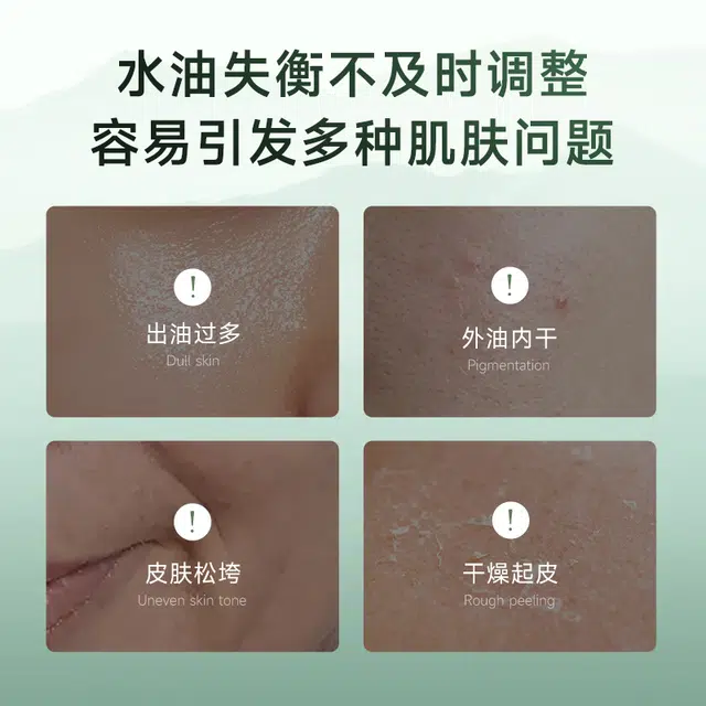 安安金纯 芦荟男士控油补水乳液 保湿清爽润肤