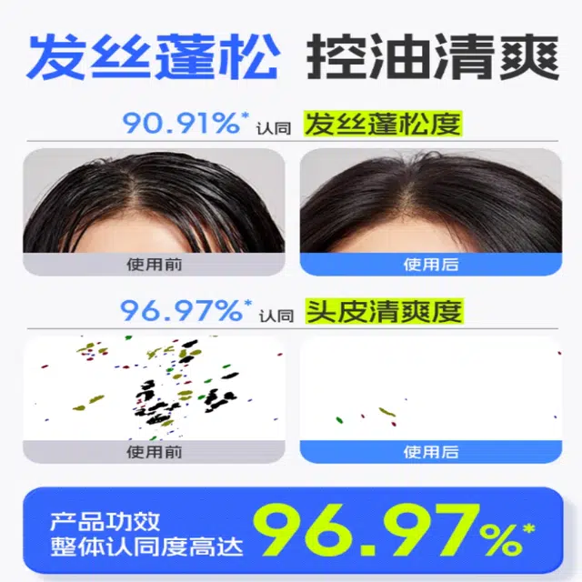 艾芭薇 青少年祛痘洁面乳控油蓬松洗发套装 祛痘舒缓保湿清爽控油清洁
