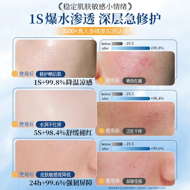 YALOIS b5 25ml*10