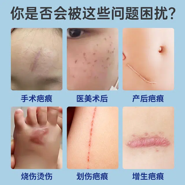 aiHUJia 20g