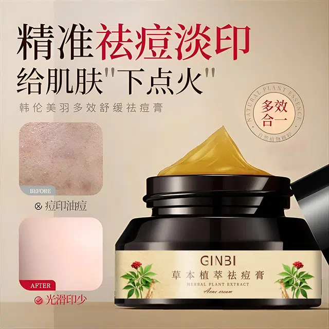 GINBI