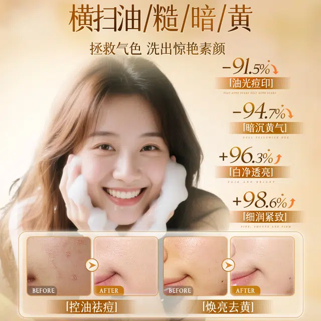维特丝 黄芪洗面奶去黄提亮洁面乳 控油祛痘以黄祛黄嫩白养肤紧致 去角质去黑头收缩毛孔淡痘印清洁祛粉刺 草本配方温和除螨