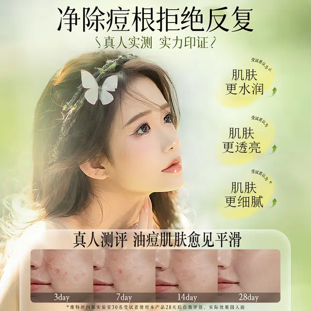 维特丝 层孔菌保湿水乳套装   控油提亮收缩毛孔 修护淡纹滋润紧致补水 精华水/精华乳