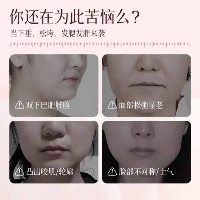 vsve V 5