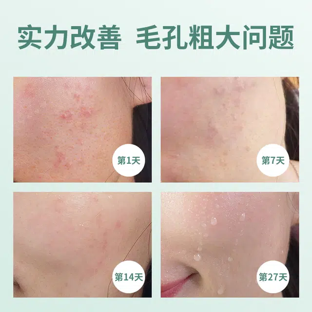 80ml