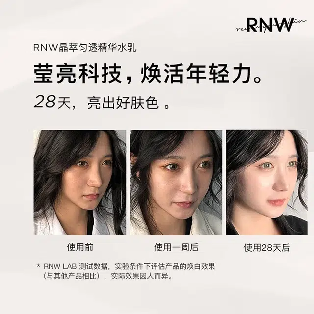 RNW