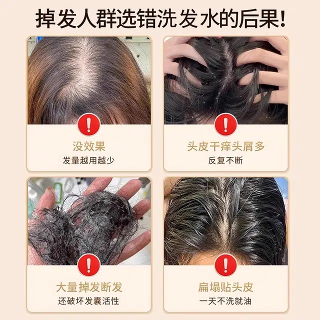 青幽堂防脱去屑套装 去屑防脱
