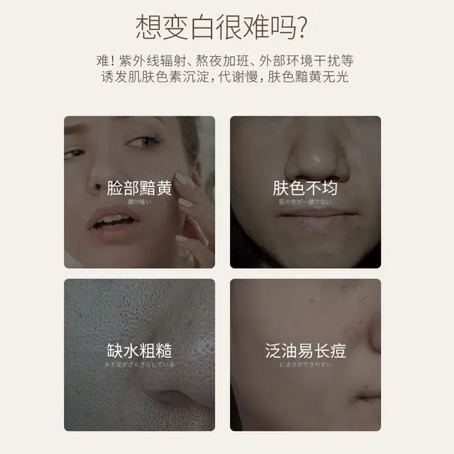 儒意 美白祛斑补水面膜 美白提亮肤色 祛黄祛斑淡斑 淡化痘印 控油补水保湿 改善暗沉肤色 收缩毛孔 舒缓修护