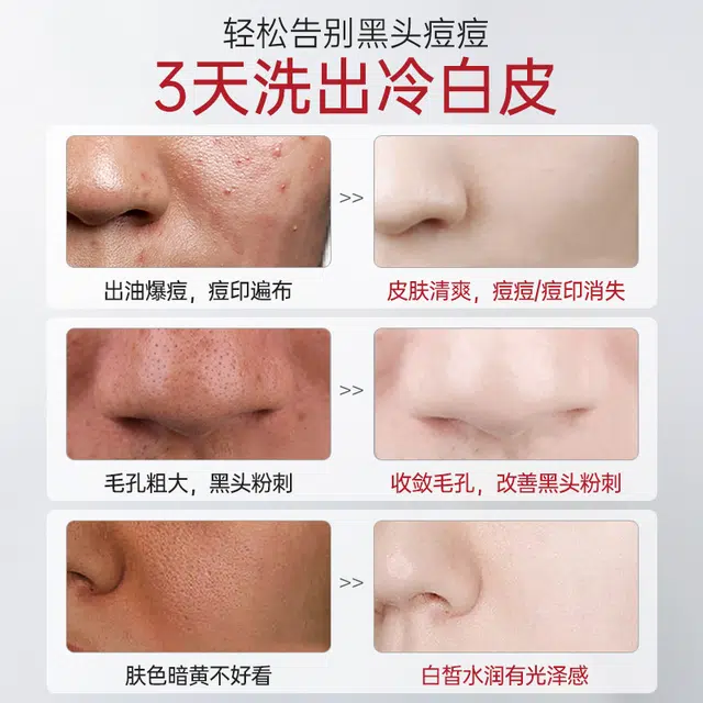 500g500g*2500g*2