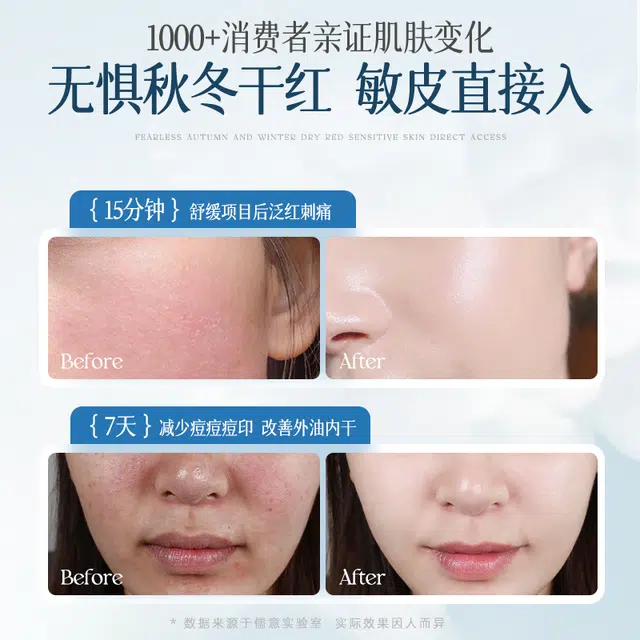 B5 100ml+100ml