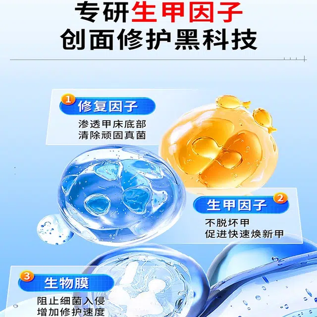 修正 医用灰指甲/甲沟炎专用抑菌液正品医用敷料