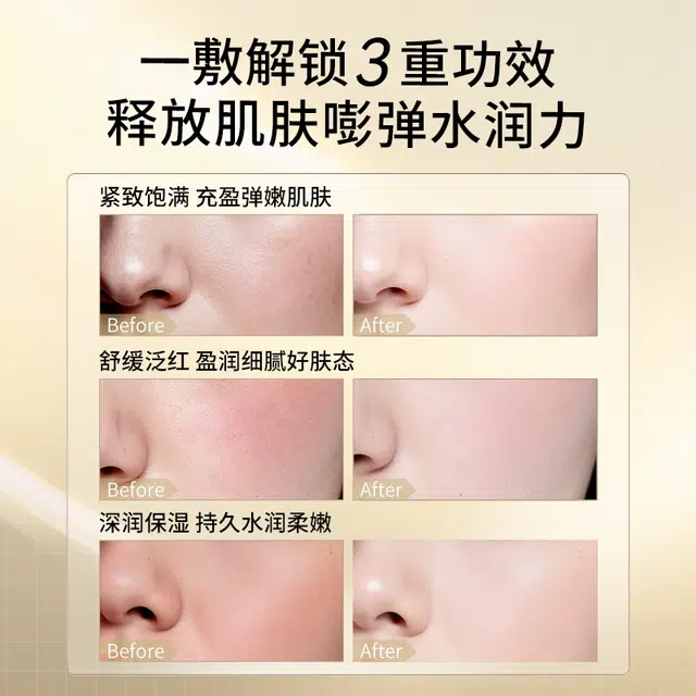 SDX 25ml*5