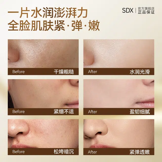 SDX *5