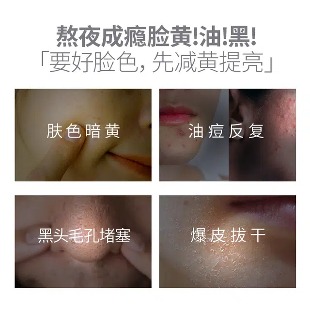 黛伦莎 烟酰胺水乳护肤套装 保湿修护去角质去黑头控油提亮收缩毛孔淡化细纹淡痘印淡纹清洁清爽滋润祛痘紧致毛孔维稳舒缓补水