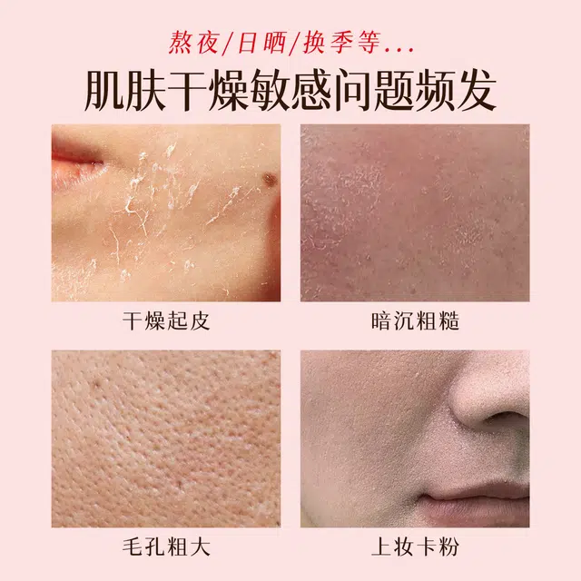 婷美 舒缓护肤套装 保湿补水 深层修护滋润改善干燥