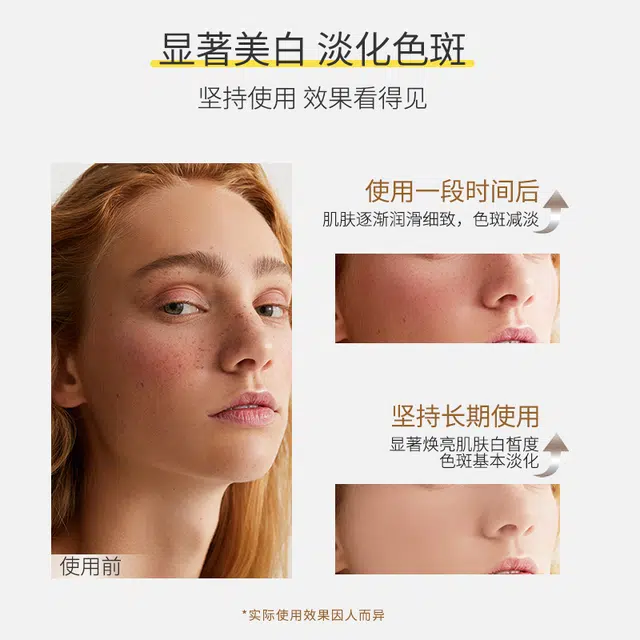 高缇雅祛斑精华液 提亮淡斑美白补水