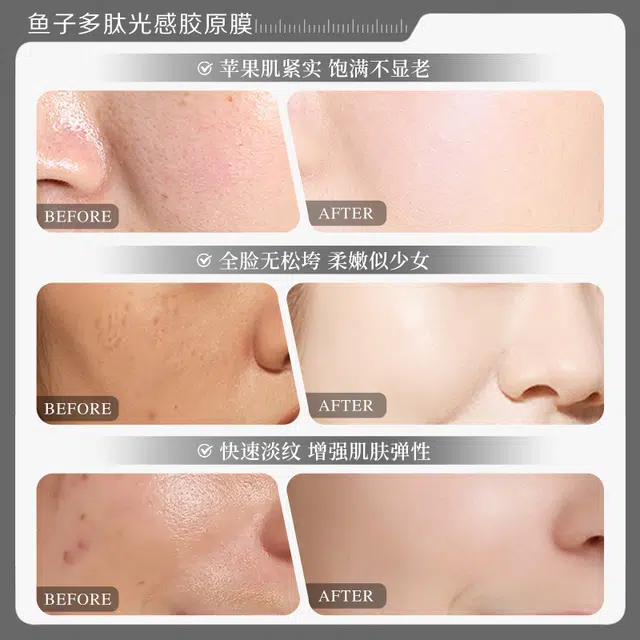 瑜然美 鱼子多肽光感胶原涂抹面膜补水保湿滋润肌肤紧致提亮肤色 保湿滋润紧致补水 多种肤质敏感性肤质混合型肤质