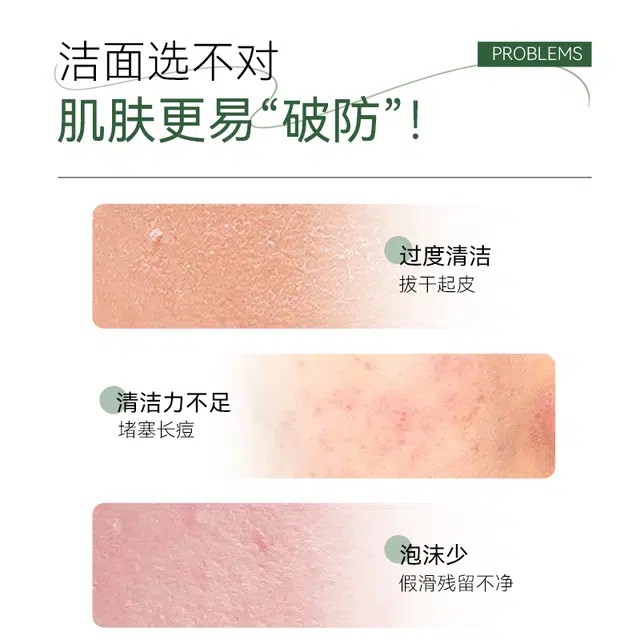 倍膳健 氨基酸洗面奶 去黑头控油收缩毛孔清洁清爽祛痘