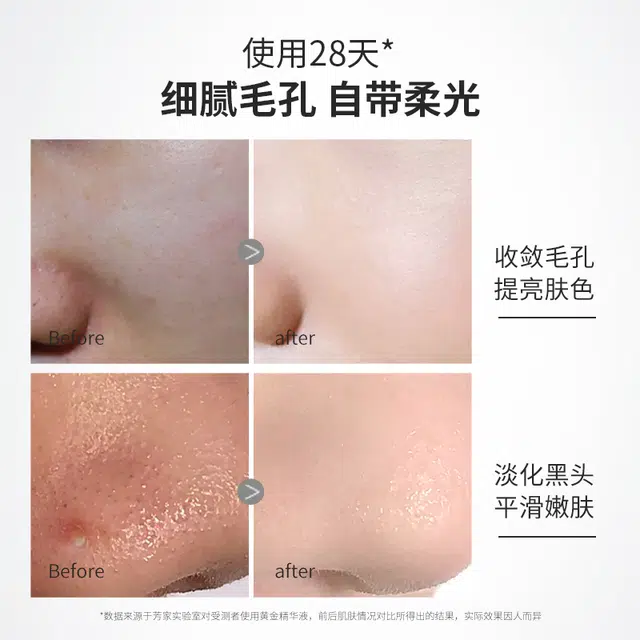 135ml