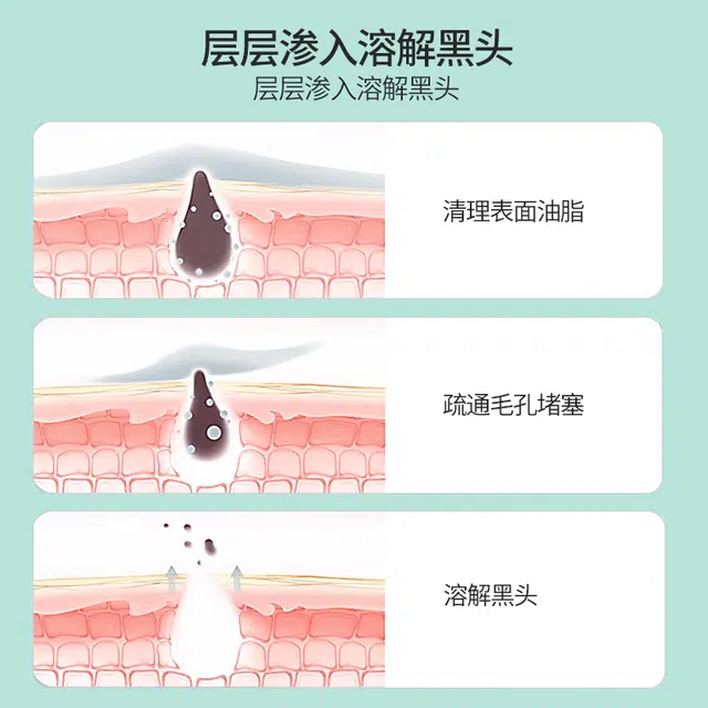 1.5ml*20