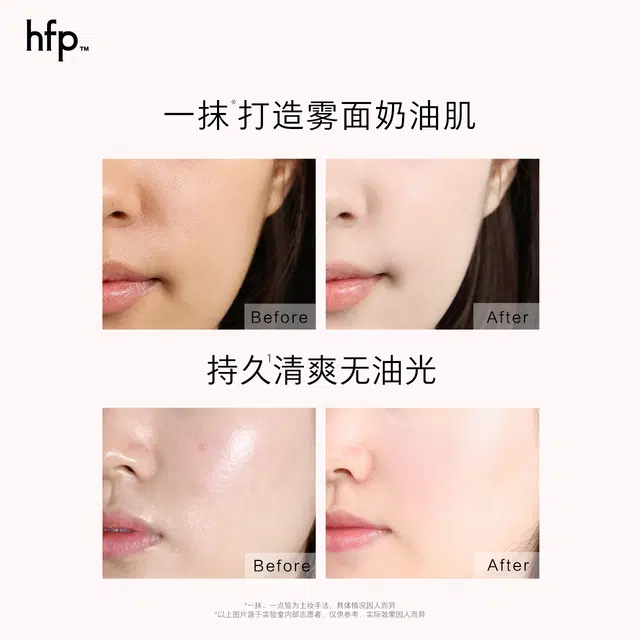 HFP