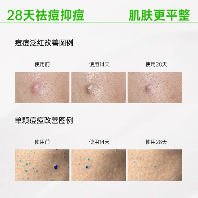 VT 100 2ml*7