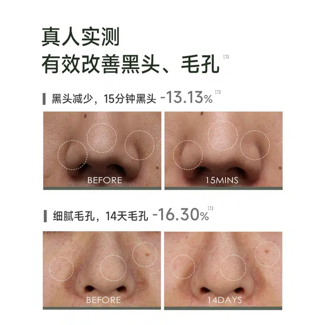 科颜萃 清洁泥膜棒+氨基酸洁面 舒缓维稳去黑头控油清洁 亚马逊白泥男士女士通用温和好冲洗
