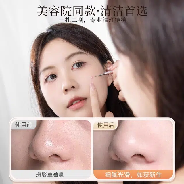 妮丽雅 扭盖粉刺针挤痘痘工具