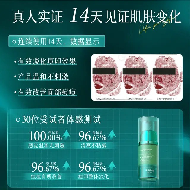 SNYN 15ml15ml*2