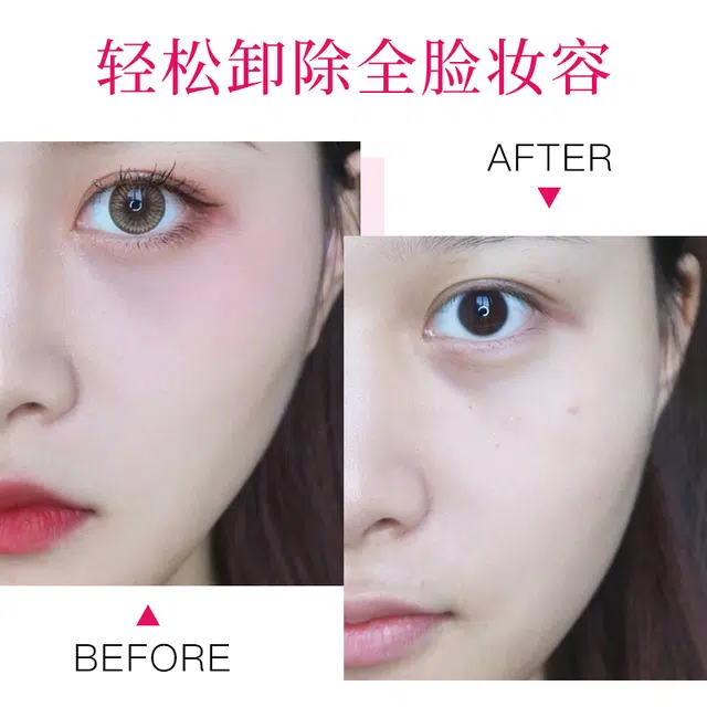 HEYXI