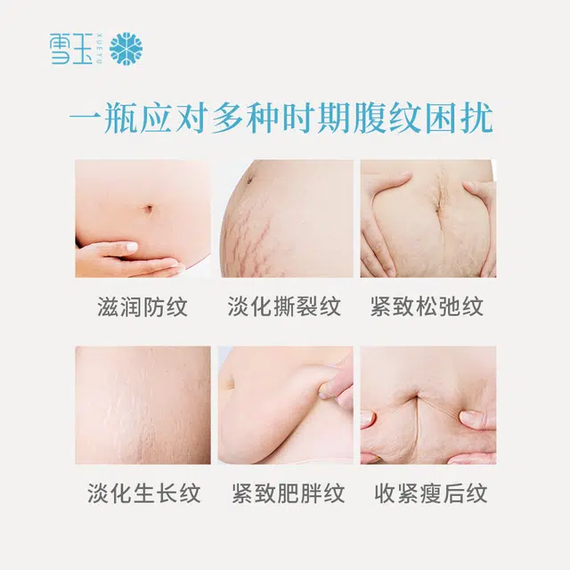雪玉 紧致淡纹腹泥 保湿补水