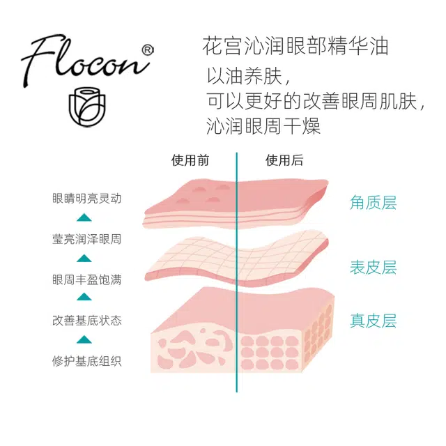 Flocon