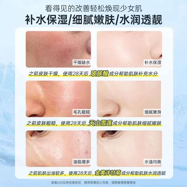 荣晟 天山雪莲玻尿酸冰感喷雾 保湿