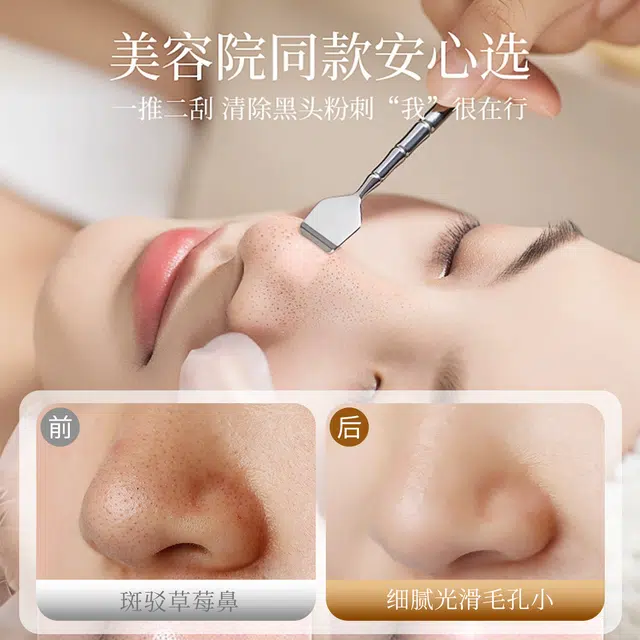古迪 双头不锈钢黑头铲 鼻子清洁神器手动去颗粒专用铲刮粉刺针毛囊清理工具