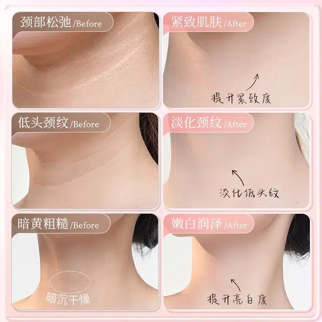 古迪 升级颈膜固定带 可水洗颈部敷脖子面膜颈带硅胶颈纹贴护颈脖套