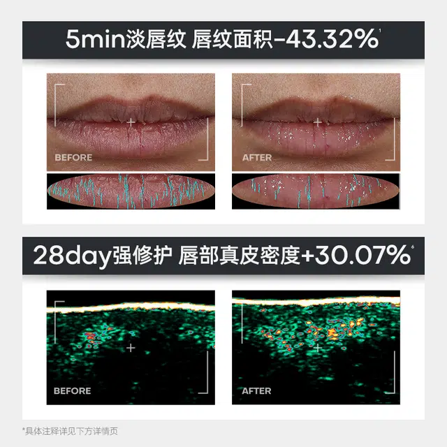 诺卜 唇部精华护唇全家桶 保湿修护提亮淡纹滋润舒缓补水