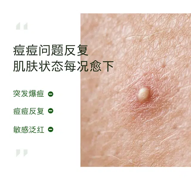 30ml