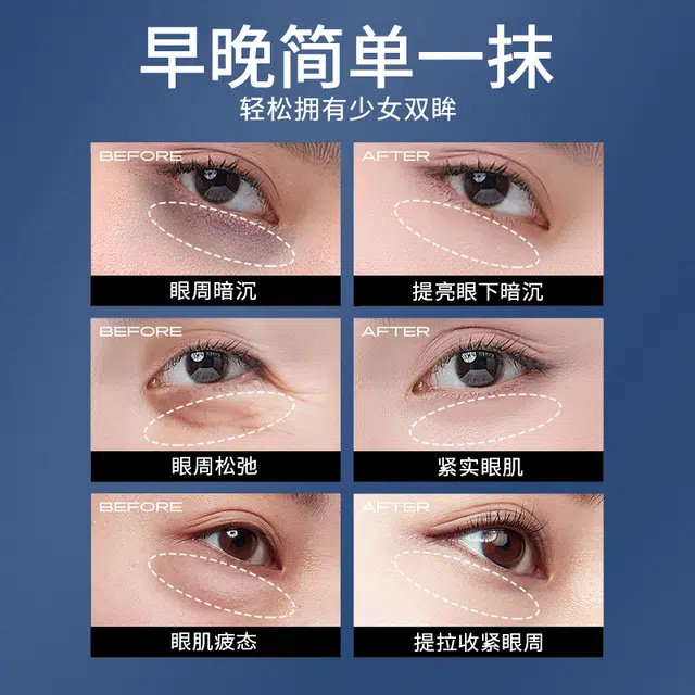 亚玛莉莎 玻色因淡化细纹眼霜 去黑眼圈抗皱提拉紧致改善眼部暗沉改善眼部浮肿淡纹紧致 淡化鱼尾纹去眼袋