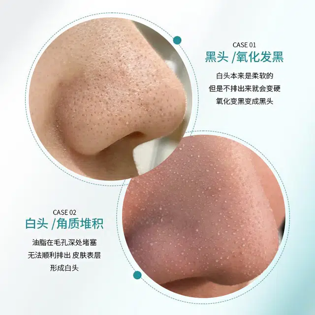 150ml